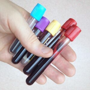 Vacutainer blood bottles